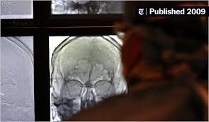 Propofol, the main brand of anesthesia drug, could very well contribute to hair thinning and hair loss, but it hasn't been proven. Breaching The Blood Brain Barrier With Avastin To Fight Glioblastoma The New York Times