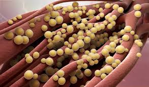 Aureus) è un batterio che frequentemente colonizza, senza alcuna . Stafilococco Aureo Cos E Sintomi Cause Complicanze Cura Pazienti It