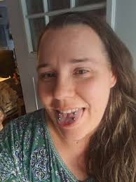 i had my daith done about a month ago and it's still super swollen and it's  getting bumps, it's not painful but a bit itchy. i use saline solution  twice a day