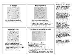 Configure your own clock using the form below and then click get clock code button Clock Drawings And Test Scores For Patients Without Dementia And Those Download Scientific Diagram