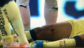 A los treinta y siete minutos del. Giovani Dos Santos Las Lesiones Mas Terribles En La Historia Del Futbol Imagenes Pertubadoras Para Todos Fotos Futbol Internacional Depor