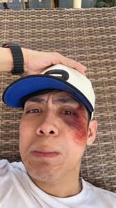 Ba't mo naman ginulat kuya 😭😭 Dingdong Bahan Patrick Ramirez  #DongPatInPBB #PBB11LeGENdaryStart #PBBGen11 #DongPat #dingdongbahan  #patrickramirez #kastarfish #boyslove