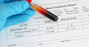 Kitajskaya Medicina Lechenie Vysokogo Kreatinina Creatinine Levels Low Protein Diet Urea In Blood