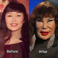 Film star Lyn may unrecognisable after jealous friend injected her face  with cooking oil😓 #reel #reels #reelsinstagram #angelinajolie #makeup  #explore #explorepage #exploremore #explorepage✨ #reelsvideo #viralreels  #reelsinstagram #reelsinsta ...