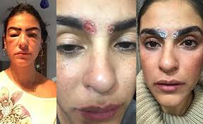 Ven a lashes & go madrid barcelona valencia marbella el microblading es perfecto en aquellos casos de ausencia de vello en la ceja, independientemente del motivo de la alopecia (lesiones cutáneas. Que Es El Microblading Y Como Saber Donde Hacerselo Revista Caras