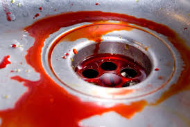 In diesen beitrag geht es um sexuelle schmerzstörungen bei frauen. Schmerzen Nach Dem Sex Ist Meine Scheide Wie Eine Offene Wunde Express De