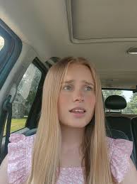 Brandy Billy Eye Update