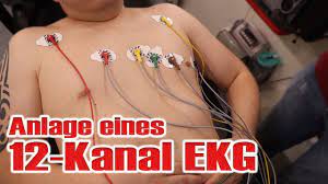12-Kanal-EKG-Kleber