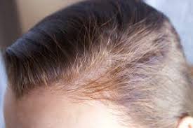 La Coloration Vegetale Et Les Cheveux Blancs Coloration Vegetale Coloration Vegetale Cheveux Blancs Coloration Naturelle Cheveux