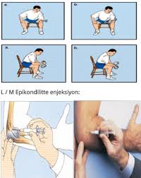 Aktifizyo 110.210 views7 months ago. Nonartikuler Romatizma Bursit Tendinit Vb Prof Dr Meral Kozakcioglu Ozekici Fizikom Istanbul