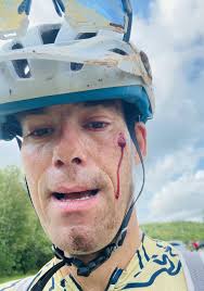 Accident tales from Truro bikers: Part 2