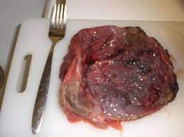 Placenta Recipes Placenta Recipes Placenta Placenta Pills