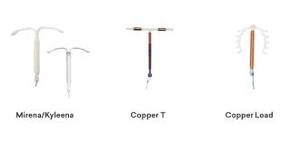 Iud or intrauterine device is a birth control method for women. Intra Uterine Device Iud Shine Sa