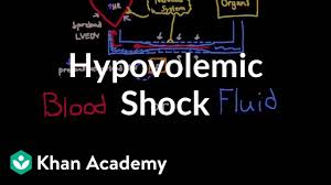 hypovolemic shock video shock khan academy