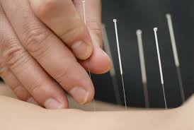We did not find results for: Acupuncture Services Port Dover Naturopath