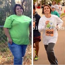 Pin On Weight Loss Surgery