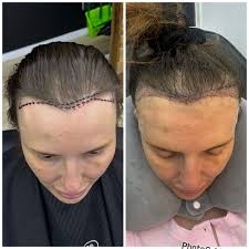 Krownd Men's Aesthetic Clinic (@krowndaesthetics) · Instagram 照片和视频