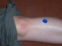 Two Acupressure Points For Menstrual Cramp Relief Menstrual Cramp Relief Menstrual Cramps Remedies For Menstrual Cramps