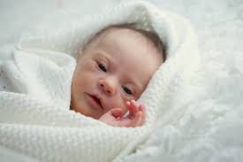 Questo bambino è stato abbandonato alla nascita, la mamma ed il papà non lo vogliamo erpchè non è sano! Neonata Con La Sindrome Di Down Rifiutata Da 7 Coppie Adottive Trova Un Papa