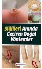 sigilleri aninda kurtaran dogal cozum dogal saglik saglik saglik urunleri