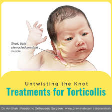 Concerned about your little one's neck? Detecting and addressing  torticollis early significantly improves outcomes. Don't hesitate to seek  professional advice- Our pediatric orthopedic specialist tailors treatment  plans to your child's unique needs.