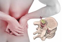 Jornada De Fisioterapia: Terapia Manual De La Columna Vertebral - Instema,  Formación para fisioterapeutas