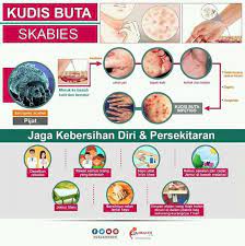 What does buta mean in english? Klinik Avicenna Apa Itu Kudis Buta Kudis Buta Atau Facebook