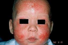 Dermapixel Lo Mas Visto En Dermapixel De Un Ano Para Olvidar