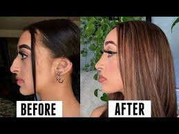 Pin By Pascale On Plastic Surgery In 2020 Nose Job Nose Celebrity Plastic Surgery