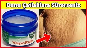 Vicks In Hic Bilmediginiz Bu Kullanim Alanlarina Sasiracaksiniz Video 2020 Deri Catlaklari Selulit Cilt Bakimi