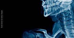 Also, reclast does not grow new bone, it is suppose to repair bone, but from all of my research, it does more harm than it could ever do good. Risk Vs Benefit Bisphosphonates In Breast Cancer