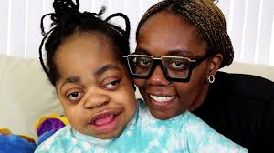 Sun is diagnosed with Hunter Syndrome, a rare and fatal disease. He began  losing his ability to walk, talk, see, and hear at just 5 years old. His  single mother, Briah, has