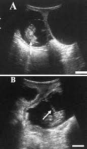Ultrasound Images Of Goat Embryo At Day 30 A And 35 B Of