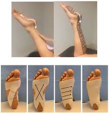 Image result for Taping for Soleus and Achilles