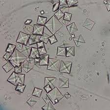 cristales de oxalato de calcio envido por lauosorioc urinarios cristales sedimentarias