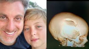 Luciano Huck Mostra Raio X Do Cranio De Benicio Apos Acidente De Wakeboard Paraiba Ja