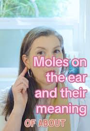 Mole in Front of Ear Meaning