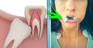 We did not find results for: Tanpa Operasi Ini 7 Cara Agar Gigi Geraham Bungsu Yang Salah Tumbuh Nggak Nyeri Lagi