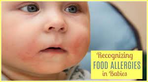 Food Allergies In Babies Who Breastfeed Common Signs And Solutions Baby Food Allergies Breastfeeding Baby Milestones