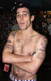 Steve-O Talked To A Doctor About Why His Voice Is So 'Messed Up'