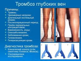 Pochemu Vo Vremya Mesyachnyh Bolyat Nogi Prichiny Bolej V Sustavah I Venah Vasha Onlajn Bolnica