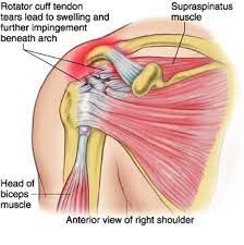 In anatomy, the scapula (plural scapulae or scapulas), also known as the shoulder bone, shoulder blade, wing bone or blade bone, is the bone that connects the humerus (upper arm bone) with the clavicle (collar bone). Rotator Cuff Tendonitis Physio Can Help