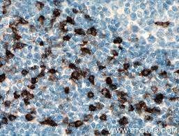 Human ccr5 is 352 amino acids (aa) in length with a predicted molecular weight of 40 kda. Ccr5 Antibody 17476 1 Ap Proteintech