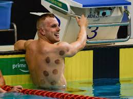 Maybe you would like to learn more about one of these? Tokyo 2020 What Are Dark Circles On Swimmers Backs The Independent