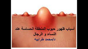أسباب ظهور حبوب المنطقة الحساسة عند النساء و الرجال . #دكتور_محمد_طرابيه -  YouTube