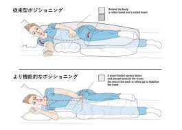 ポジショニング 側臥 位