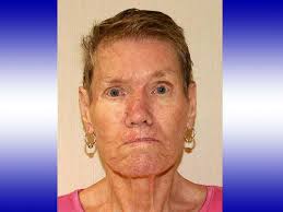 Nurse talks about caring for woman abandoned at Ala. hospital