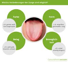 Zungendiagnostik Aus Der Traditionellen Chinesischen Medizin Tcm