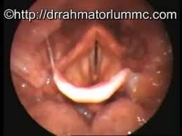 Pain that occurs when swallowing Lzpxgqu6r72sm