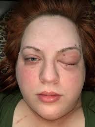 Finding Hidden Qs in a Picture Challenge